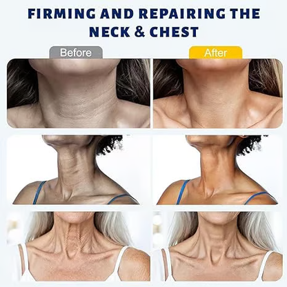 Roller Neck Firming Cream🧴 | Reduce Wrinkles & Double Chin