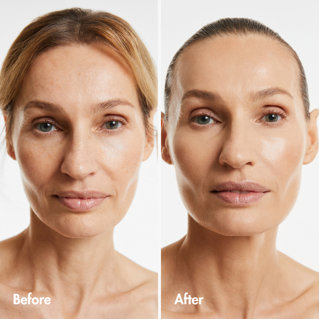 Reverse-aging Adaptive Foundation