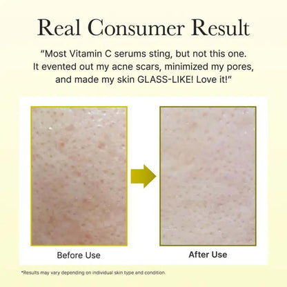 ✨ Booster Shot Skin Renewal Duo – Brightens, Hydrates & Smooths