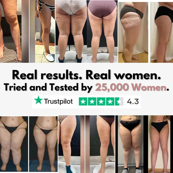 Rusticorbit 3D legging - say goodbye to lipedema pain and swelling naturally