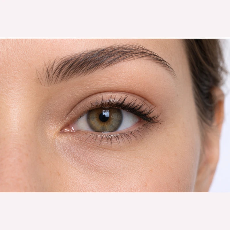 Illustrative after view: smoother-looking hazel eye upper crease