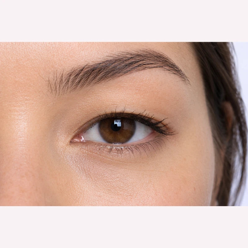 Illustrative before view: subtle eyelid crease on brown eye